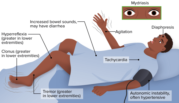 Nursing interventions for neuroleptic malignant syndrome